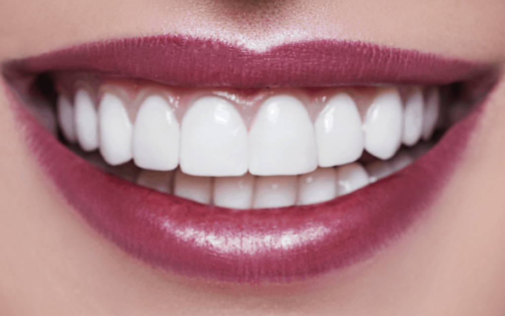 Teeth Whitening South Africa, Whitening South Africa, fläsh Whitening